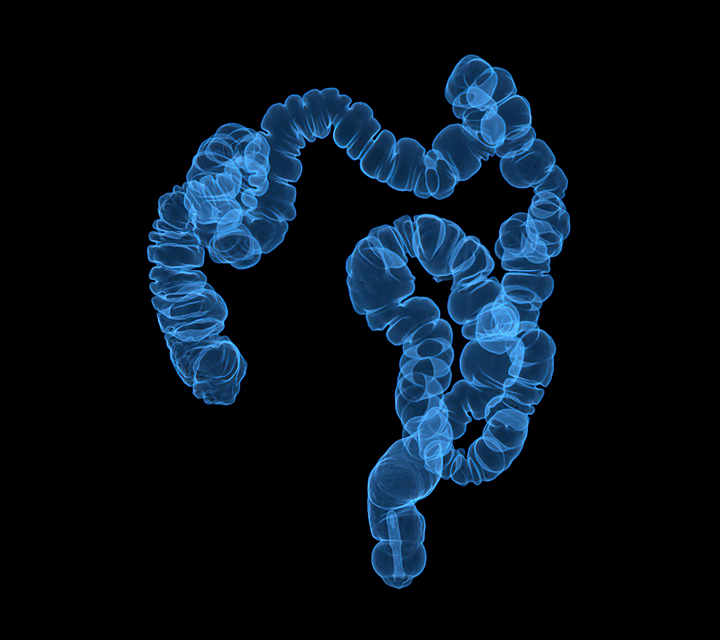 CT image of the colon in a 3D rendering, taken with a Virtual Colonoscopy.