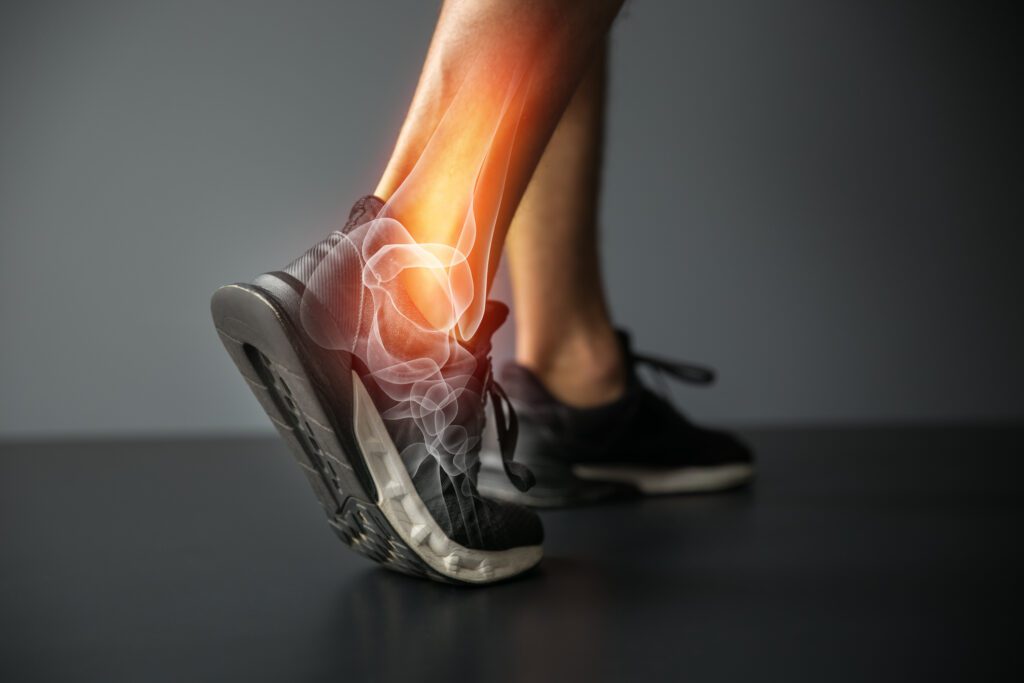 Feet taking a step, with an ankle injury and joint pain indicated by a look beneath the surface.