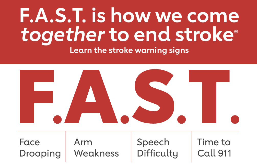 Graphic explaining the American Stroke Association's FAST method for stroke response.