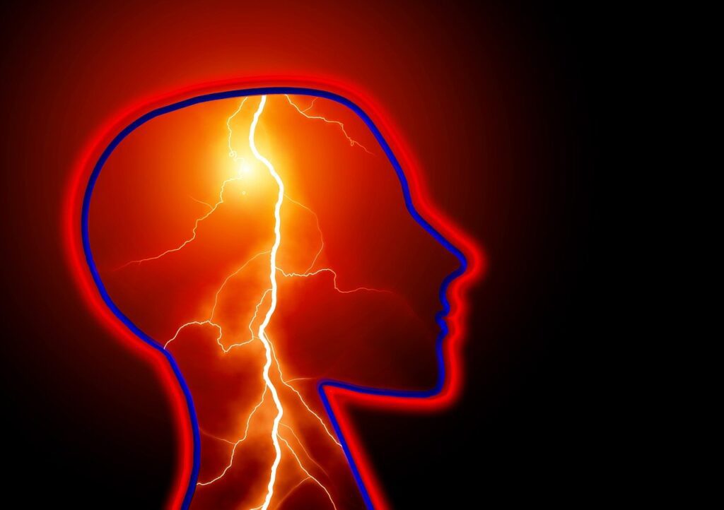 Illustration of Stroke as lighting in the brain