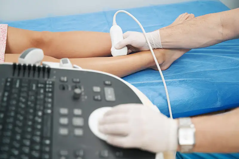 DVT Ultrasound For Leg Vein Screening